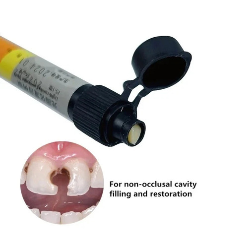New dental cement - cement, cavity