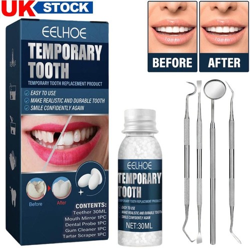 Temporary tooth filling repair - filling,