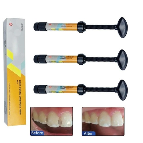 Teeth resin tooth repair - teeth,