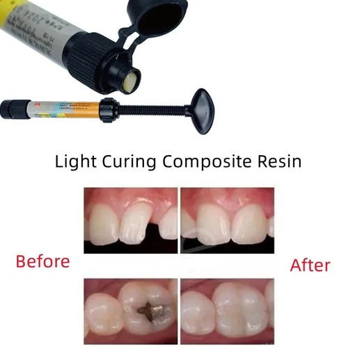 New dental cement tooth cavity - new,